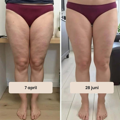 Seamless Anti-Cellulite Leggings